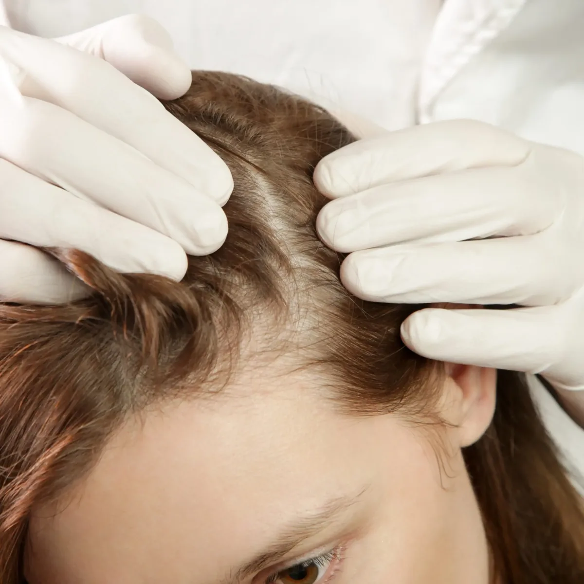 Tratamiento capilar en Althea Estetic